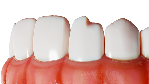 Cosmethic Dentistry